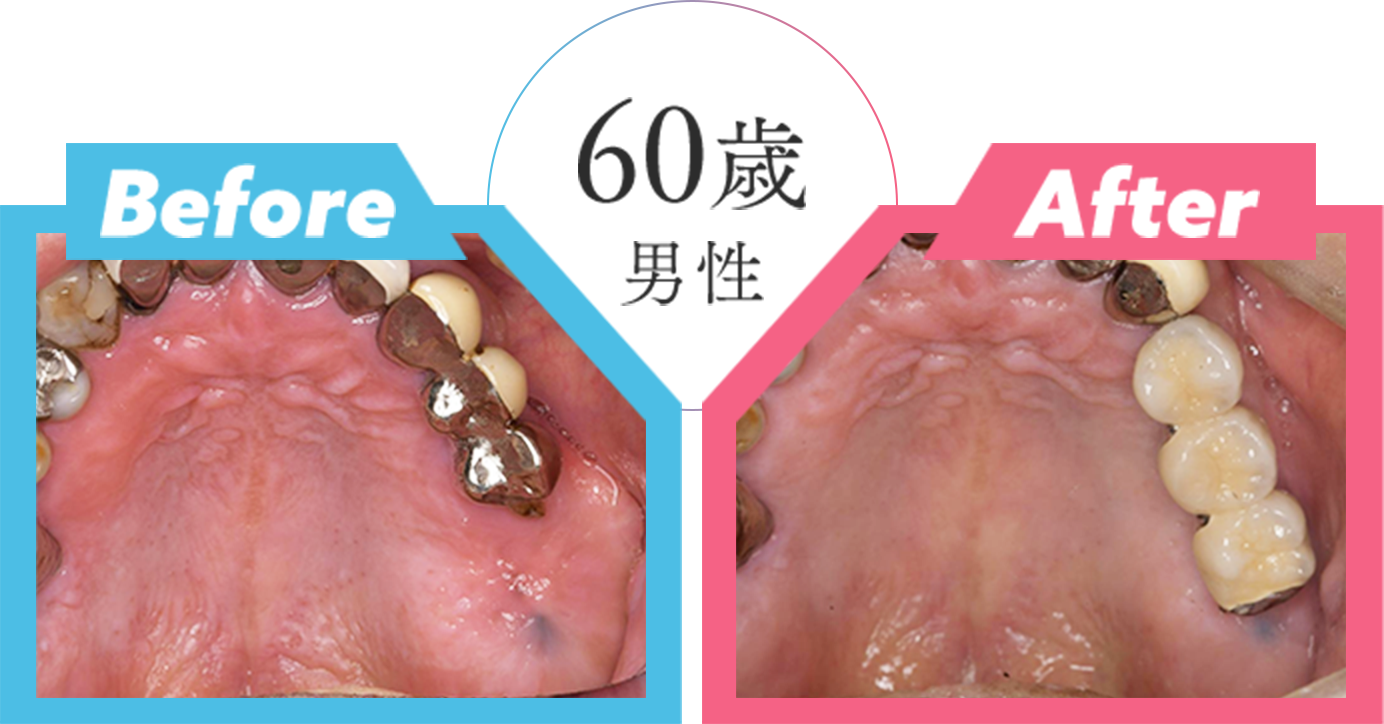 60歳男性
