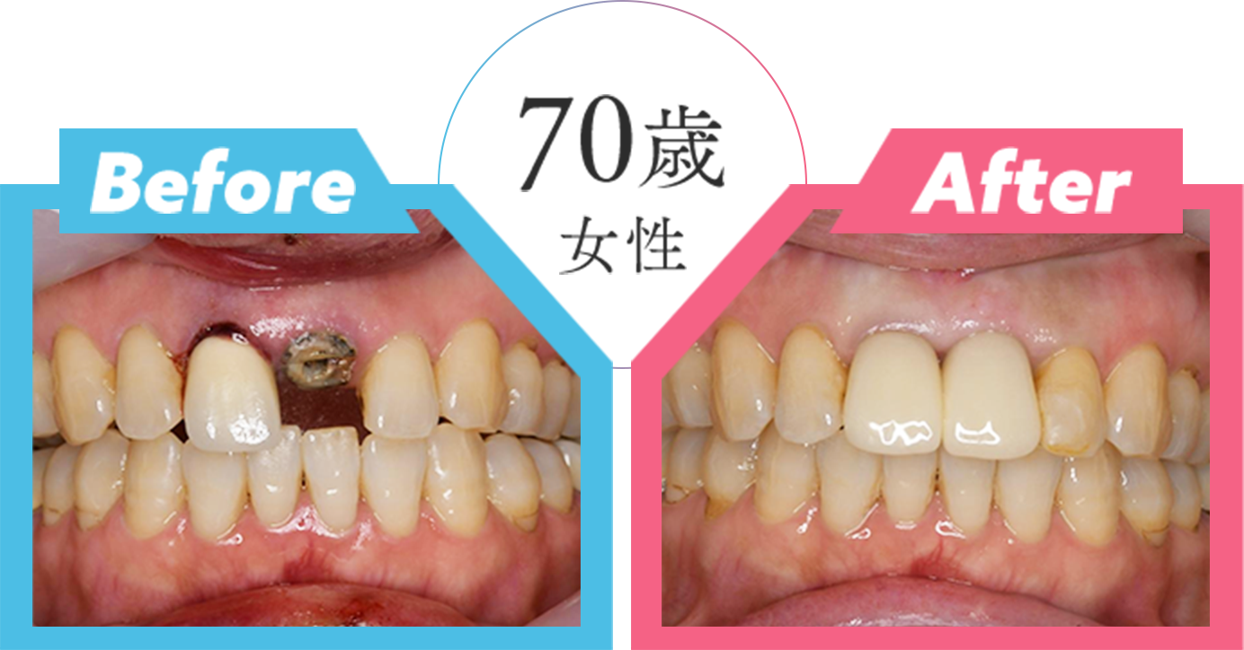70歳女性